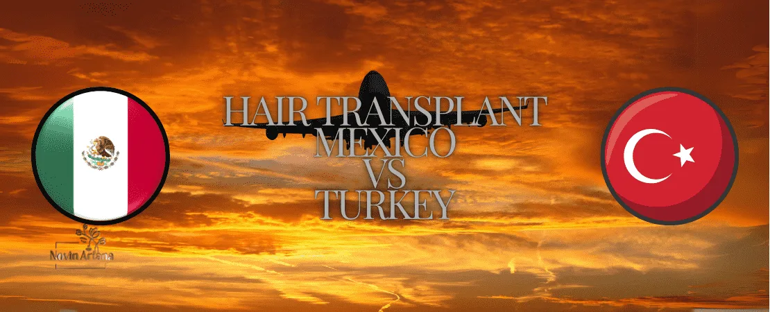 Hair Transplant Mexico VS Turkey? Where Should You Have Your Hair Transplant