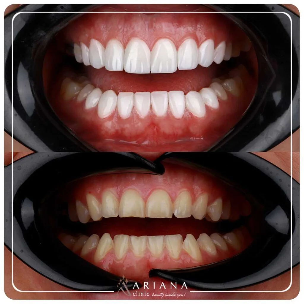 ariana dental 10 1024x1024 1