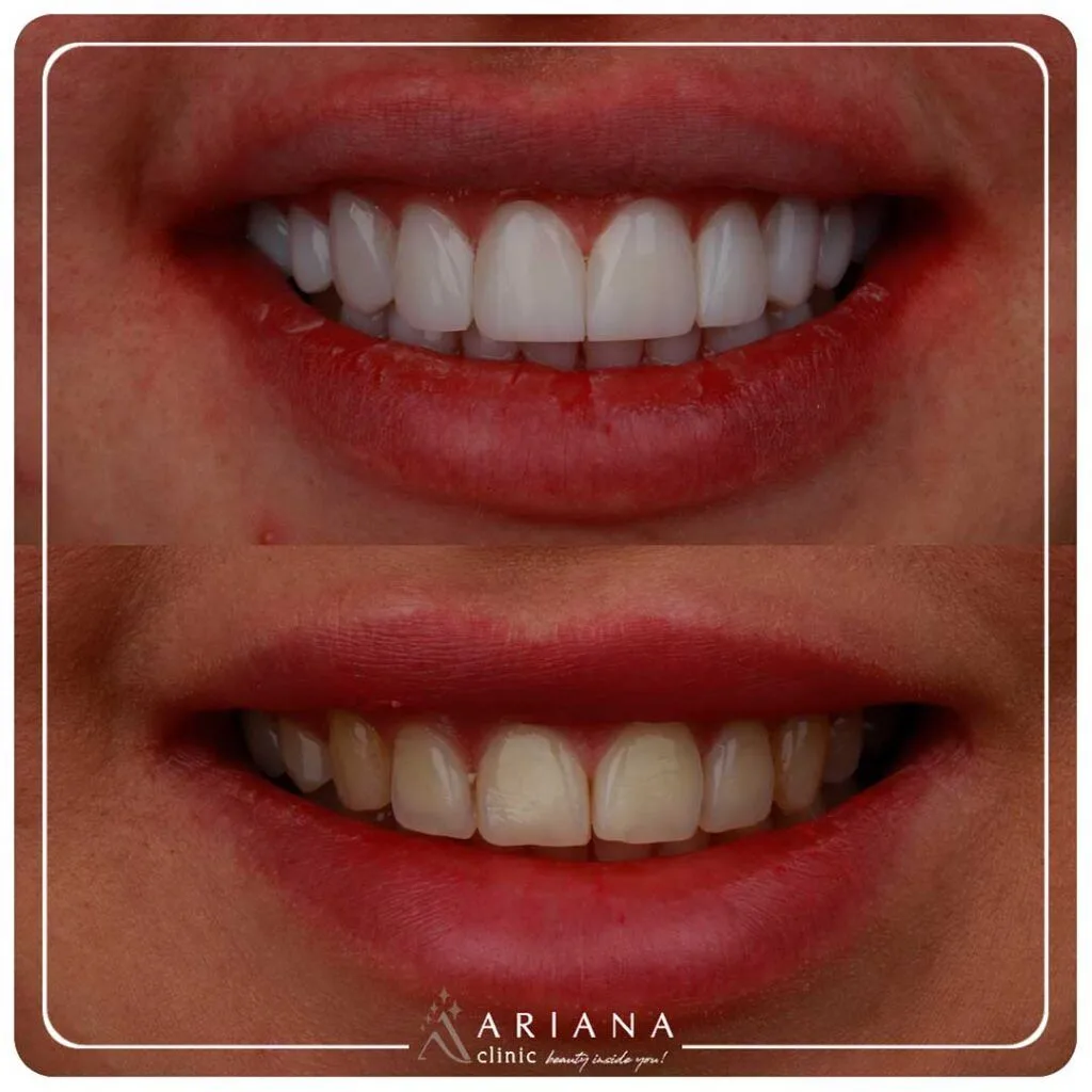 ariana dental 11 1024x1024 1