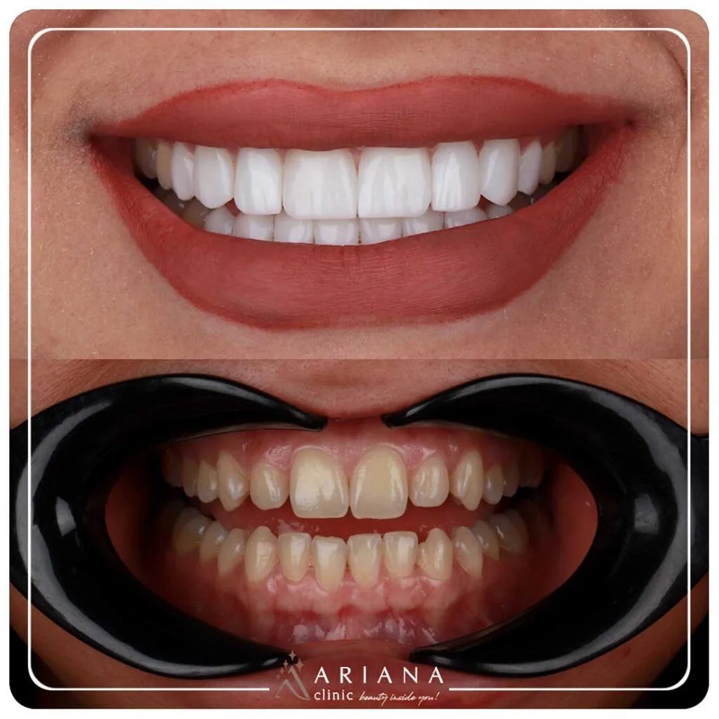 ariana dental 14 1024x1024 1
