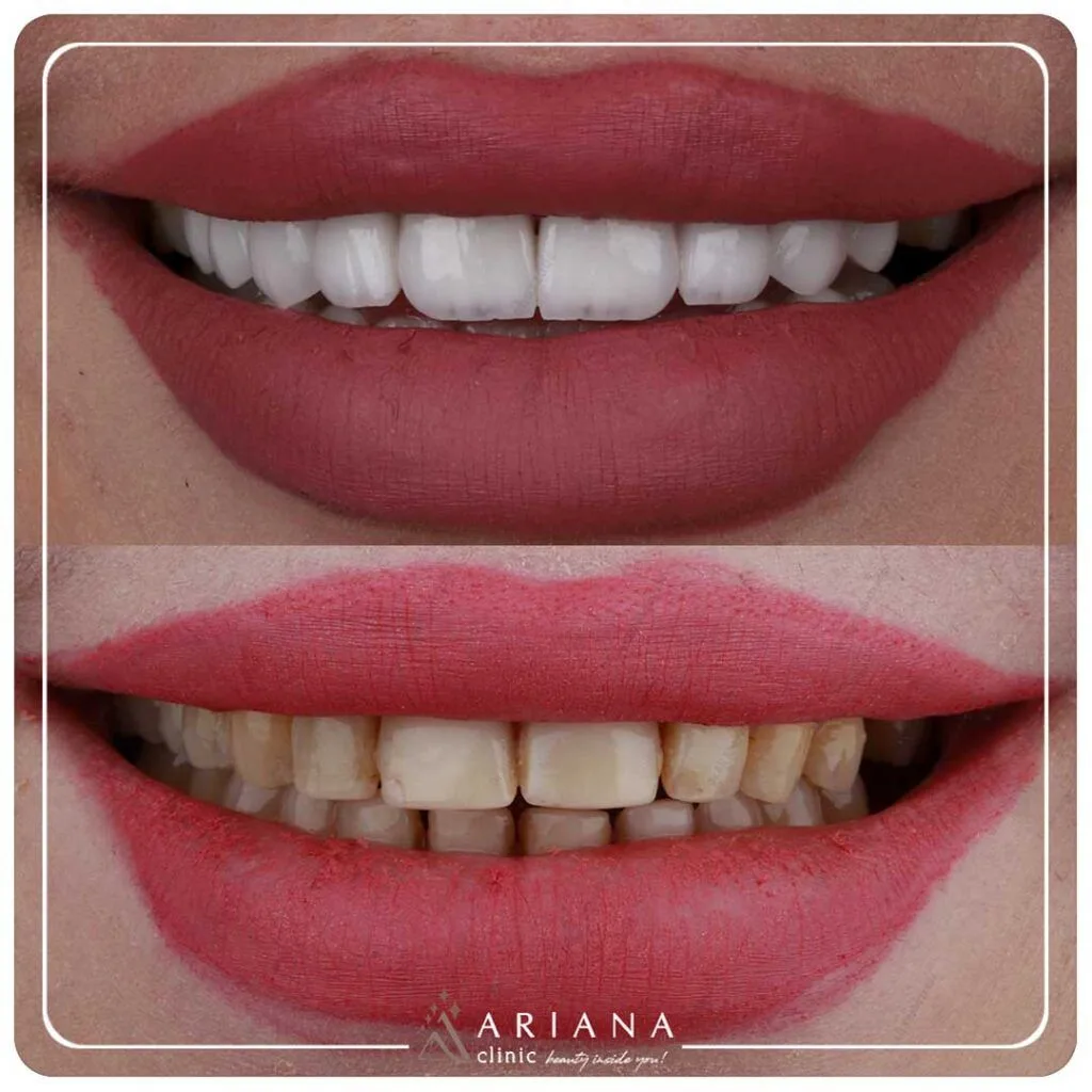 ariana dental 8 1024x1024 1
