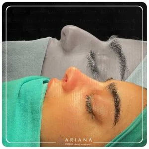 ariana-rino-3-1024x1024