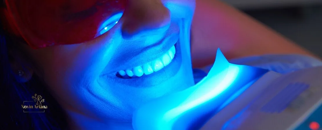 Zoom Teeth Whitening in Turkey: The Ultimate Guide