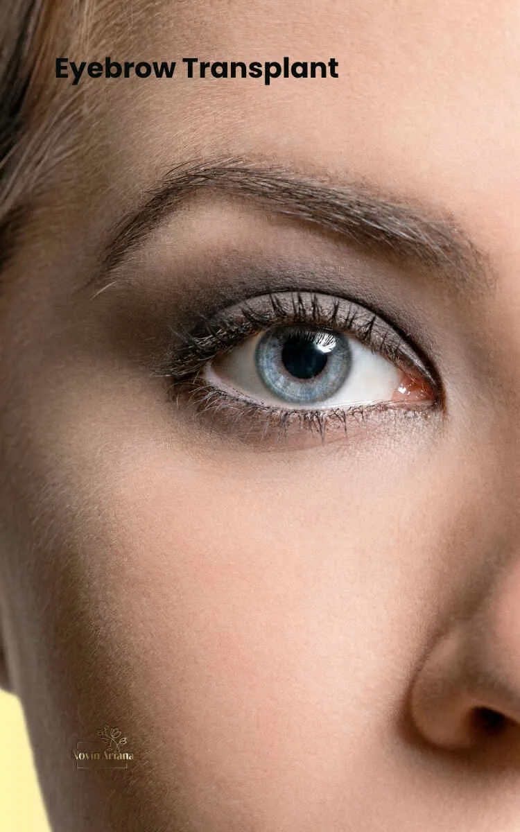 Eyebrow transplant in Istanbul Turkey