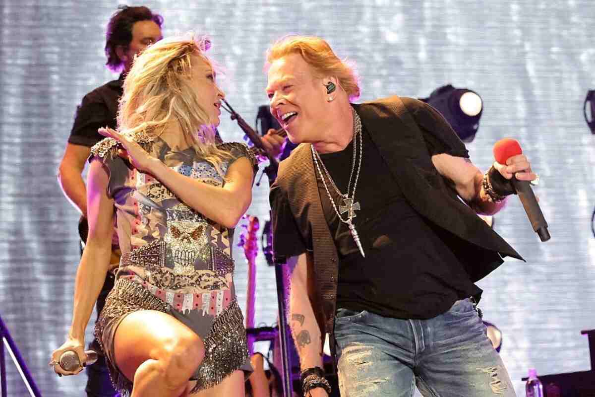 axl rose hair transplant (5)
