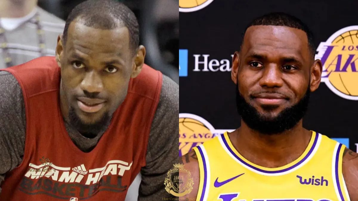 LeBron James, LeBron James hair, LeBron James hairline, LeBron James hair transplant, LeBron James hair restoration, LeBron James hair loss, hair loss, hair restoration, hair transplant, male pattern baldness, androgenetic alopecia, hair fibers, hair concealers, hair thinning, PRP hair treatment, platelet-rich plasma therapy, low-level laser therapy, LLLT for hair loss, hair restoration for athletes, hair transplant surgery, Follicular Unit Extraction, FUE hair transplant, Direct Hair Implantation, DHI hair transplant, stem cell therapy for hair loss, hair loss solutions, hairline restoration, hair grafts, celebrity hair transplants, LeBron James before and after, basketball players with hair loss, hair confidence, hair restoration treatments, hair loss in men, hair care for thinning hair, restoring confidence through hair restoration.