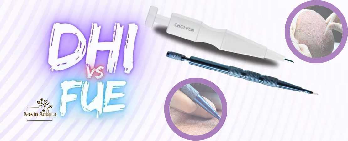 تکنیکهای کاشت مو DHI-FUE-SFUE