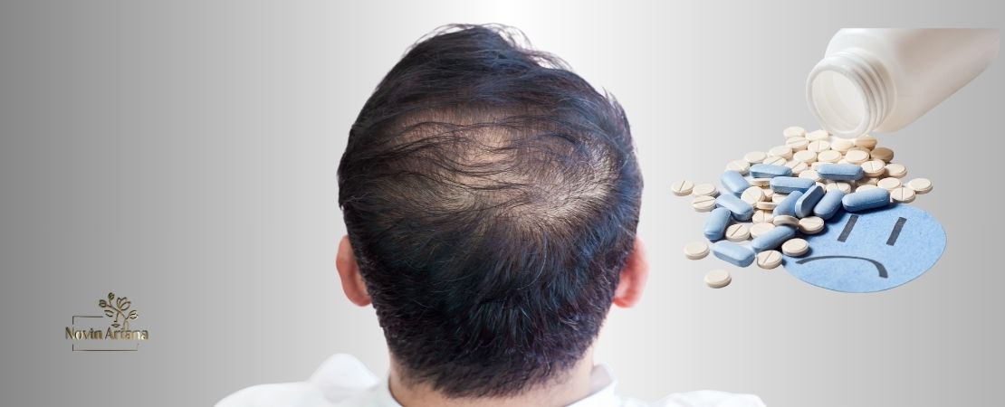 Can Lexapro Cause Hair Loss? Everything You Need to Know