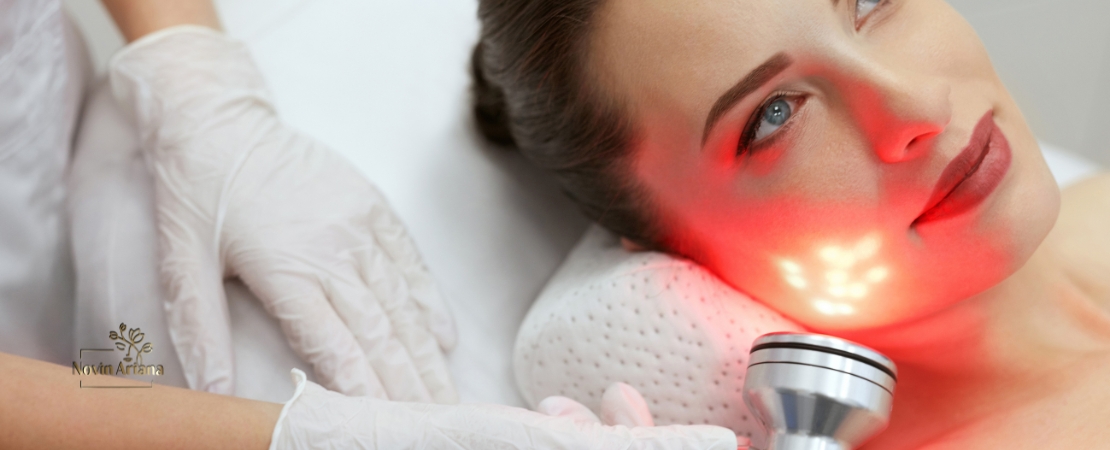 La Thérapie par Lumière Rouge pour la Chute de Cheveux : Une Solution Efficace ?