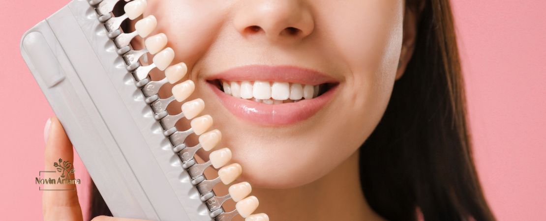 Dental Veneers: Eine Revolution in der Zahnmedizin