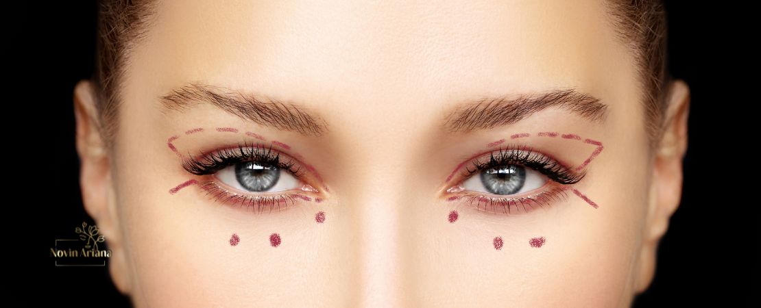 Die Oberlidstraffung: Frische Ausstrahlung für müde Augen