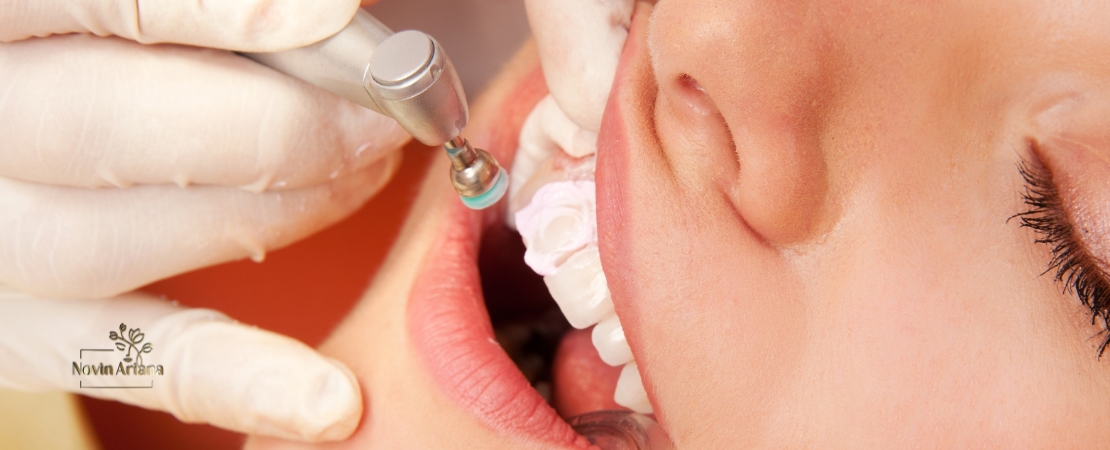 Chirurgie Dentaire : Tout savoir sur les interventions les plus courantes