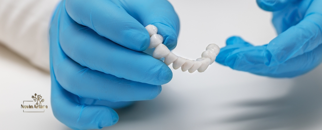 Couronnes en Zircone – Une Solution Esthétique et Durable