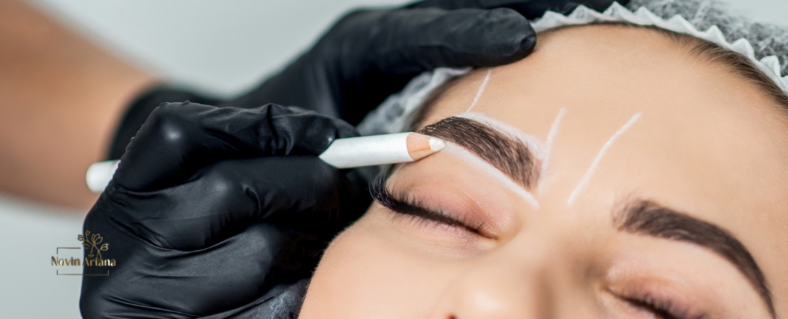 Greffe de Sourcils (Implant Sourcil) : Sublimer et Structurer le Regard