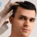 Descripción: Consigue un trasplante de cabello gratis con tecnología avanzada y resultados naturales.