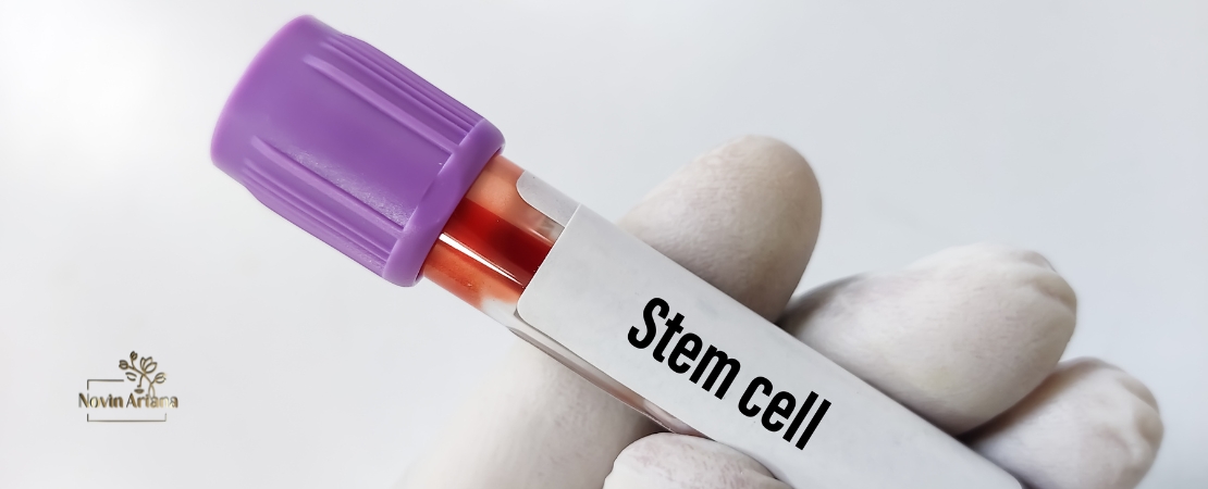 Stem Cell Hair Transplant Therapy in Turkey Advanced Hair Regeneration Treatment