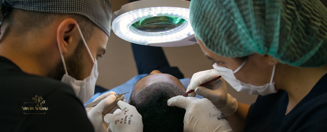 Trapianto di Capelli FUE Zaffiro: La Soluzione Innovativa per la Perdita dei Capelli