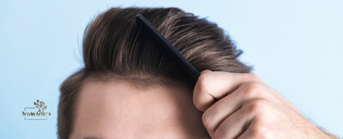 Conseils importants après une greffe de cheveux