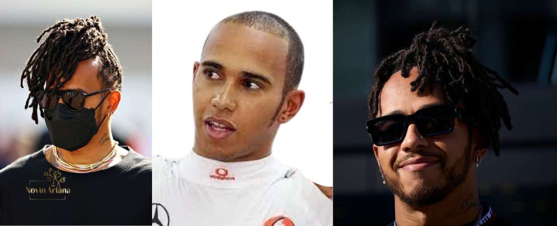 Trasplante Capilar de Lewis Hamilton: Todo lo que Debes Saber