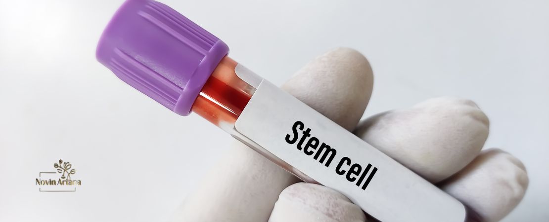Haartransplantation mit Stammzellen