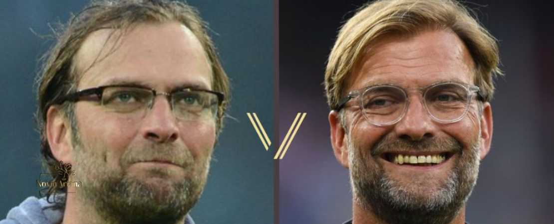 Jürgen Klopp und die haarige Sache: Die 3 Phasen seiner Haarwende