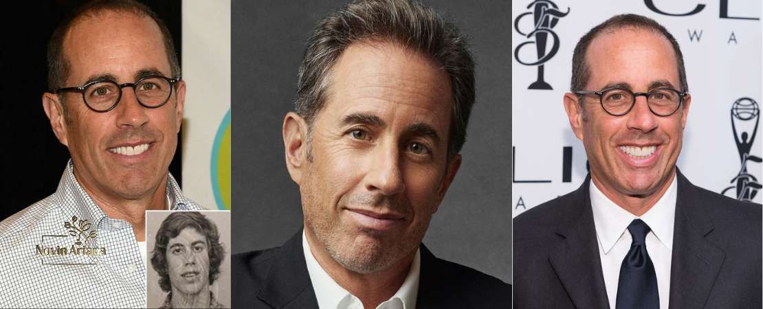 چهره جدید Jerry Seinfeld پس از جراحی مو