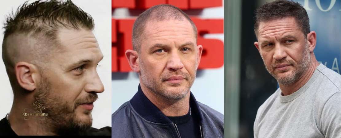 طاسی Tom Hardy یا کاشت مو تام هاردی؟