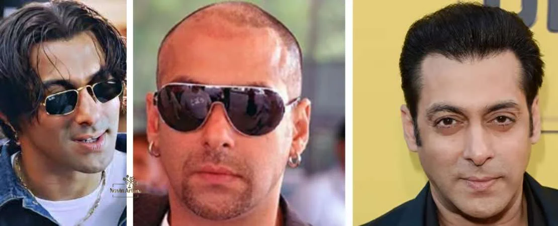 کاشت موی سلمان خان با تصاویر قبل و بعد | واقعیت ماجرای تغییر ظاهر Salman Khan