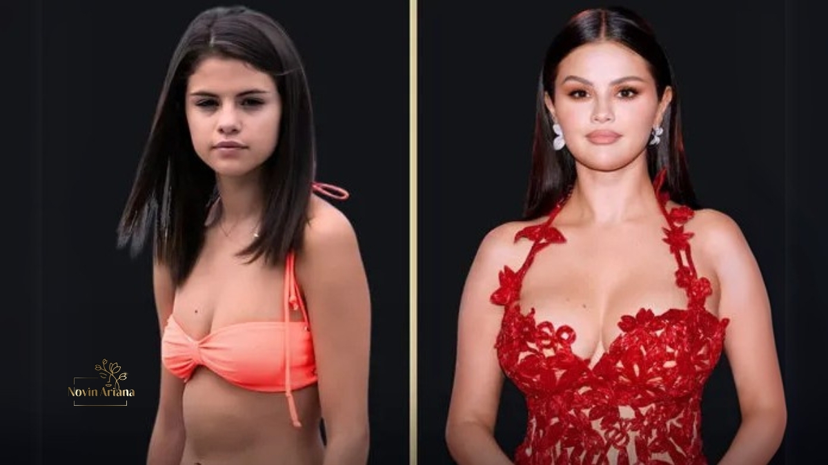 Selena Gomez boob job rumors, Selena Gomez breast implants, Selena Gomez before and after, Selena Gomez cosmetic surgery, Selena Gomez body transformation, Selena Gomez recent photos, Selena Gomez red carpet look, Celebrity breast augmentation, Hollywood cosmetic surgery trends, Plastic surgeon views Selena Gomez