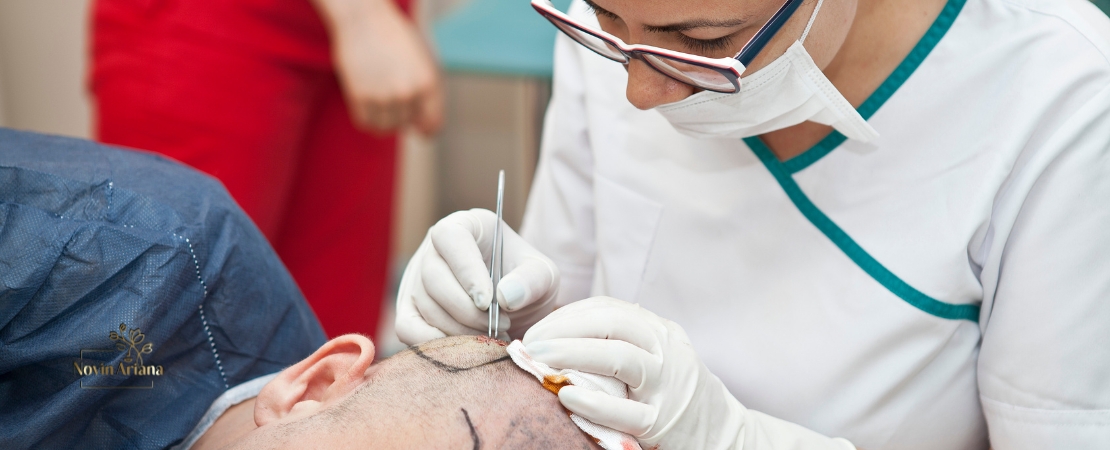 Side Effects and Risks After a Hair Transplant