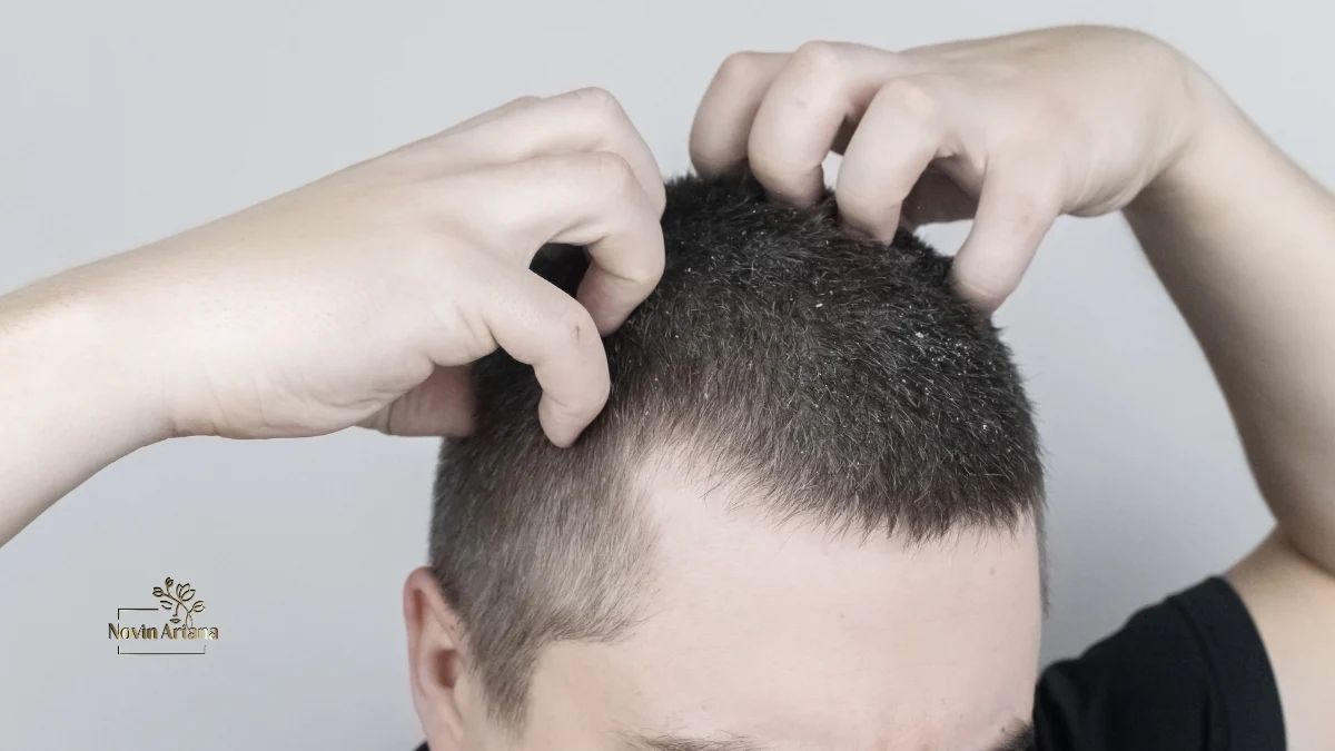 minoxidil side effects,minoxidil 5 side effects men,minoxidil 5 side effects for women, minoxidil side effects reddit beard,Minoxidil side effects sexually,Minoxidil side effects cancer,Minoxidil side effects women, Minoxidil side effects men,Minoxidil side effects after stopping,Minoxidil 5 side effects ,Oral minoxidil side effects