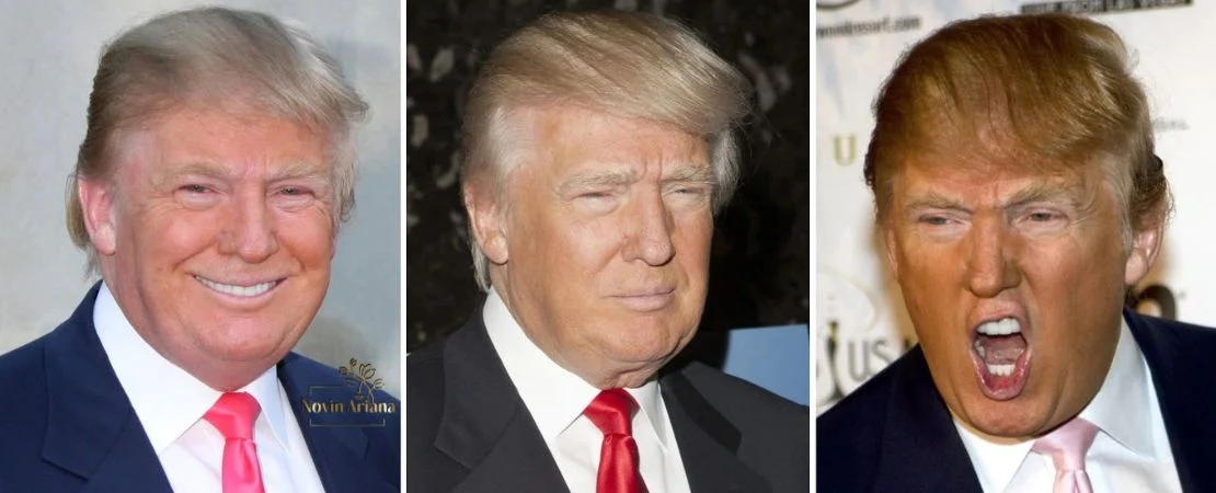 مدل موی دونالد ترامپ Donald Trumpاز شایعات کاشت مو تا جنجالهای رسانهای
