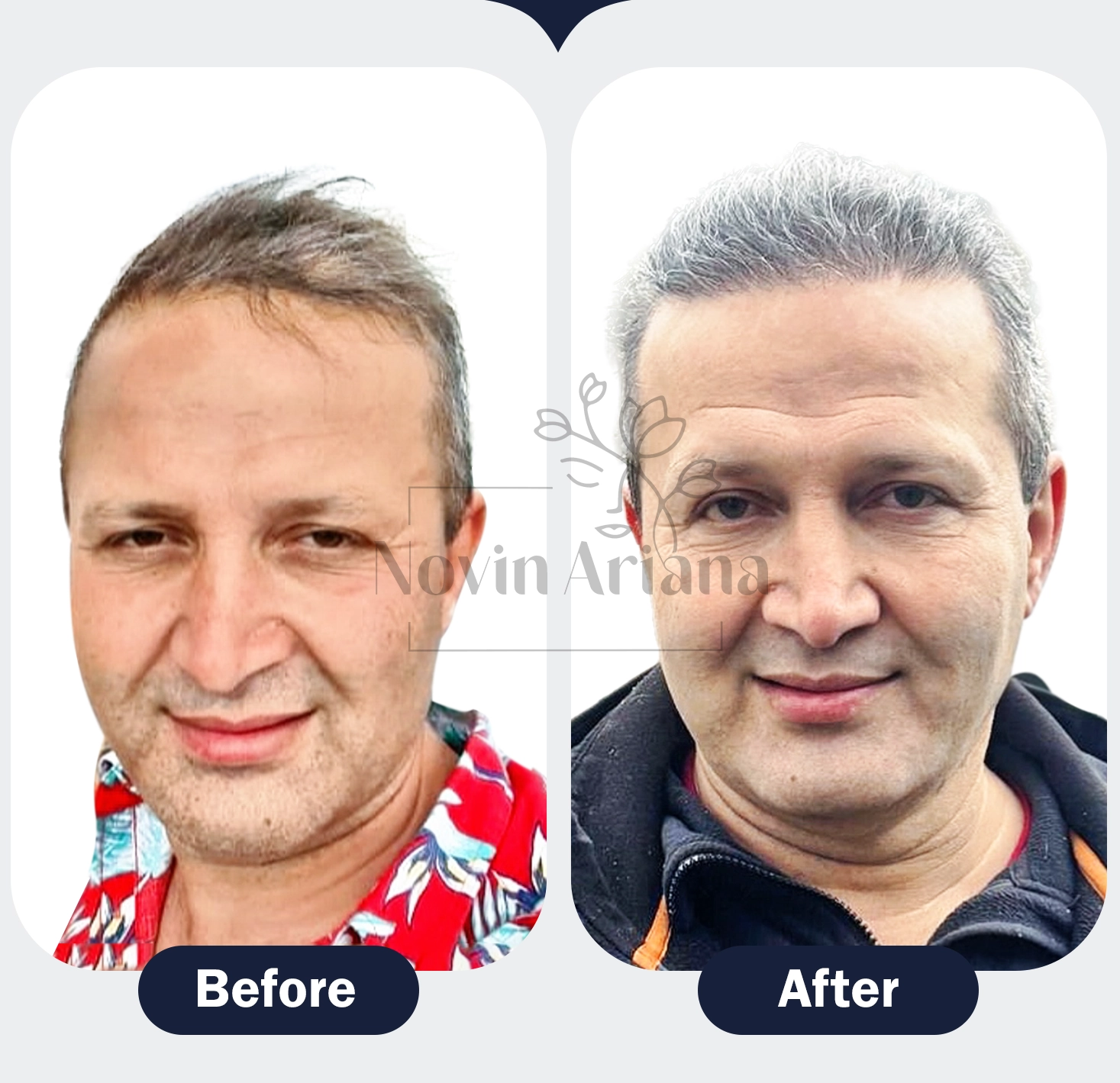 2 copy