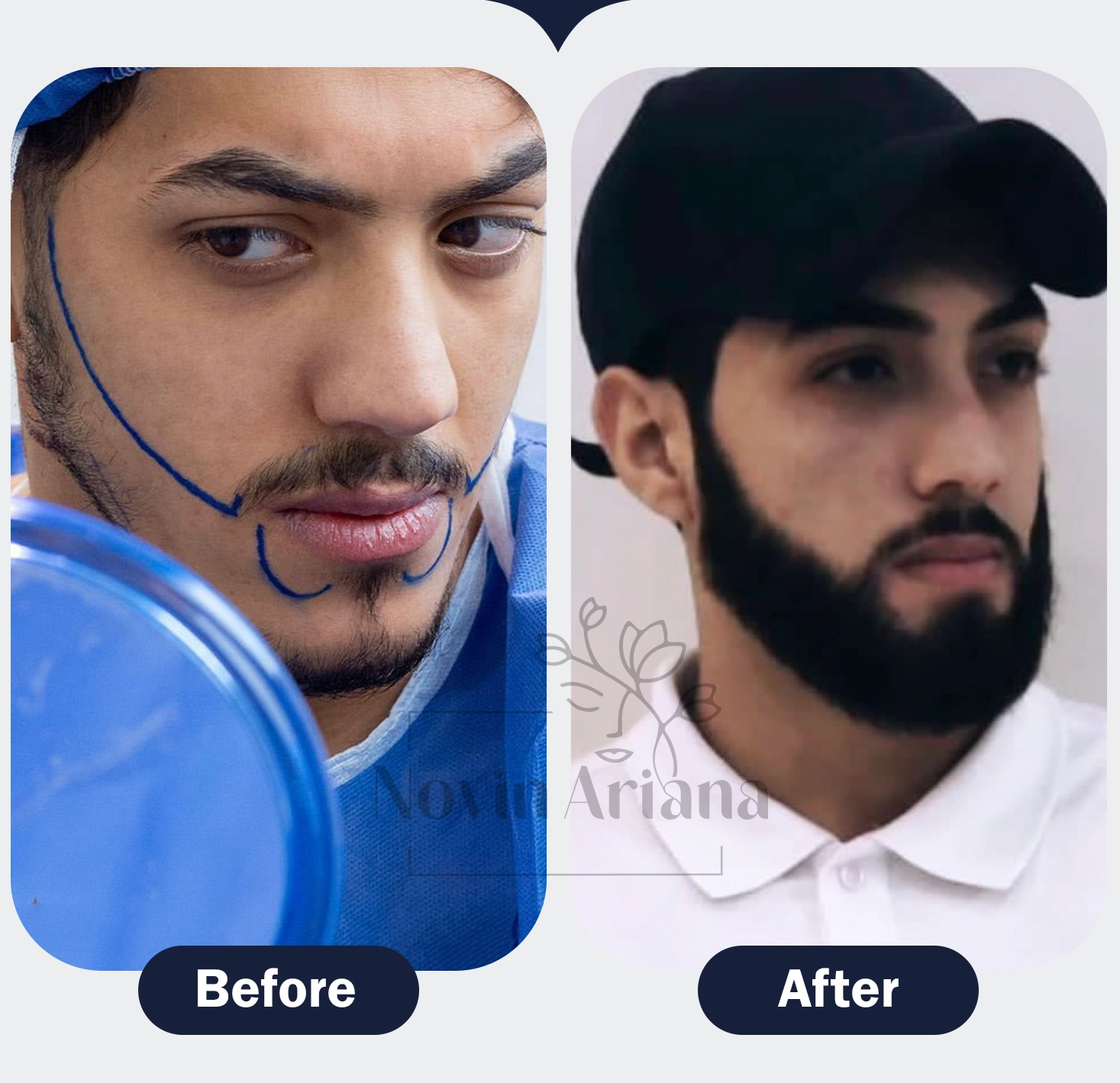 4 copy