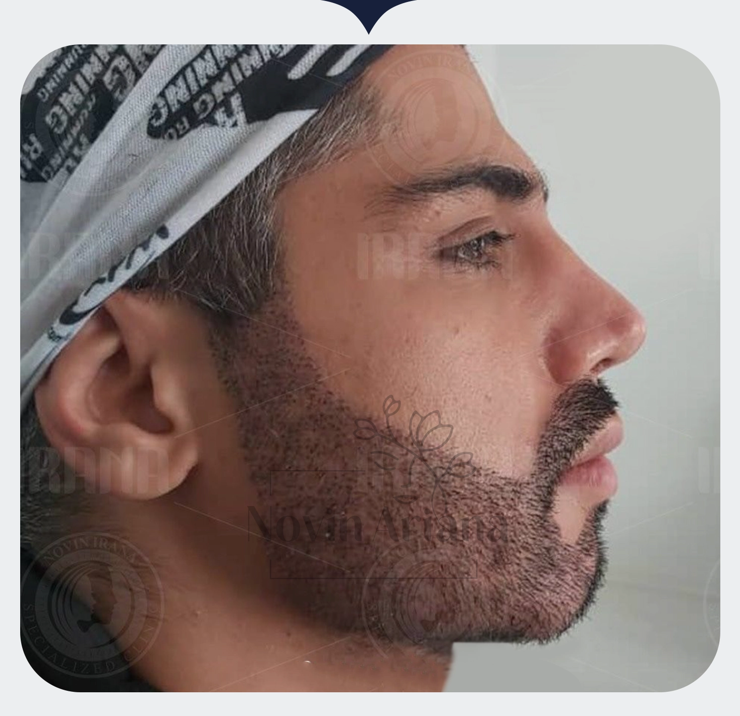 5 copy