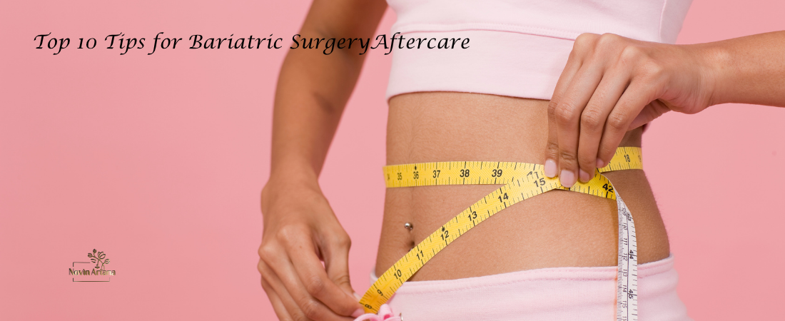 Simple Tips to Avoid Mistakes After Bariatric Surgery and Keep the Weight Off