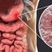 چرا کلینیک نوین اریانا در ترکیه
