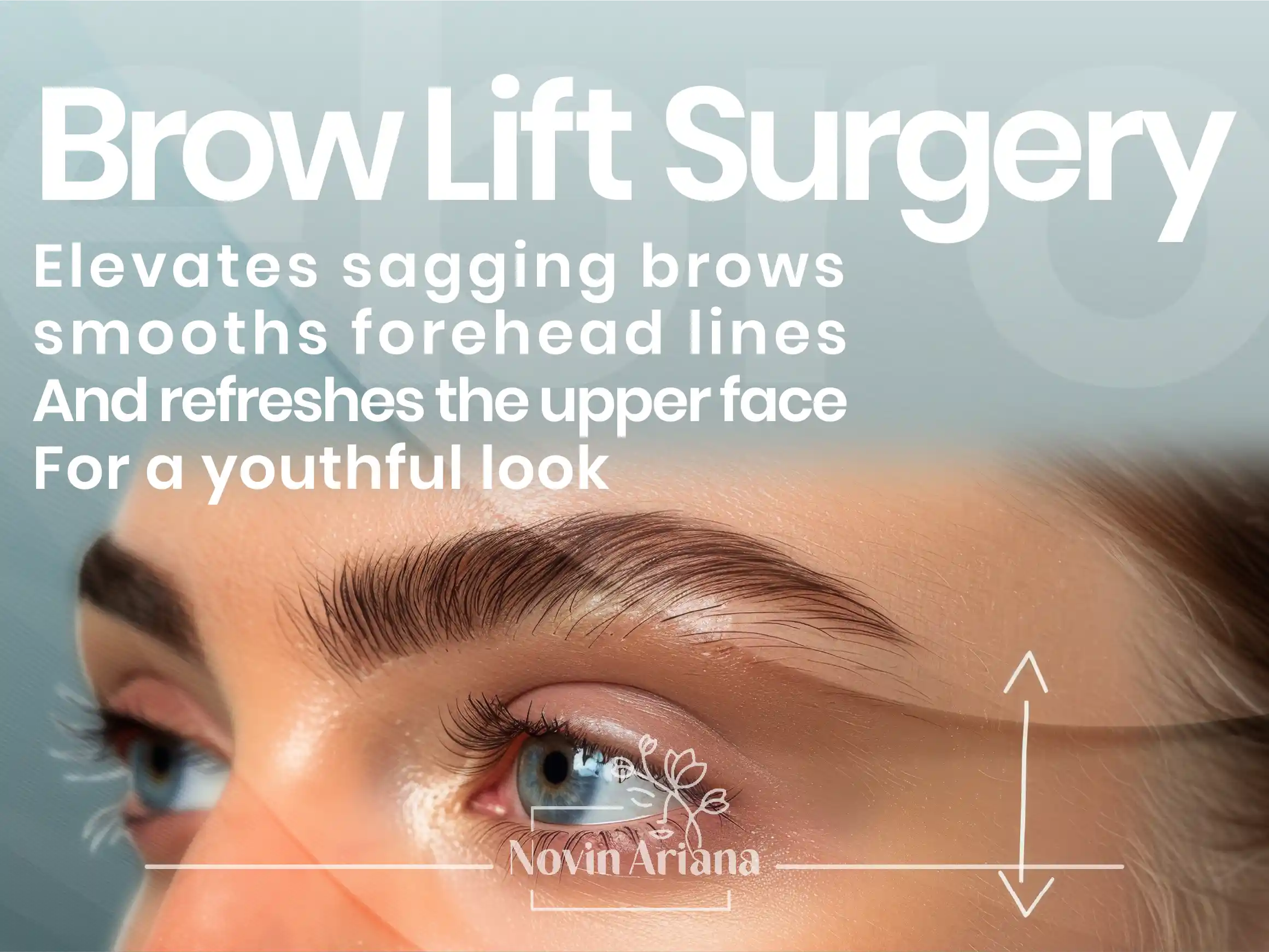 EyebrowLift 02 OP