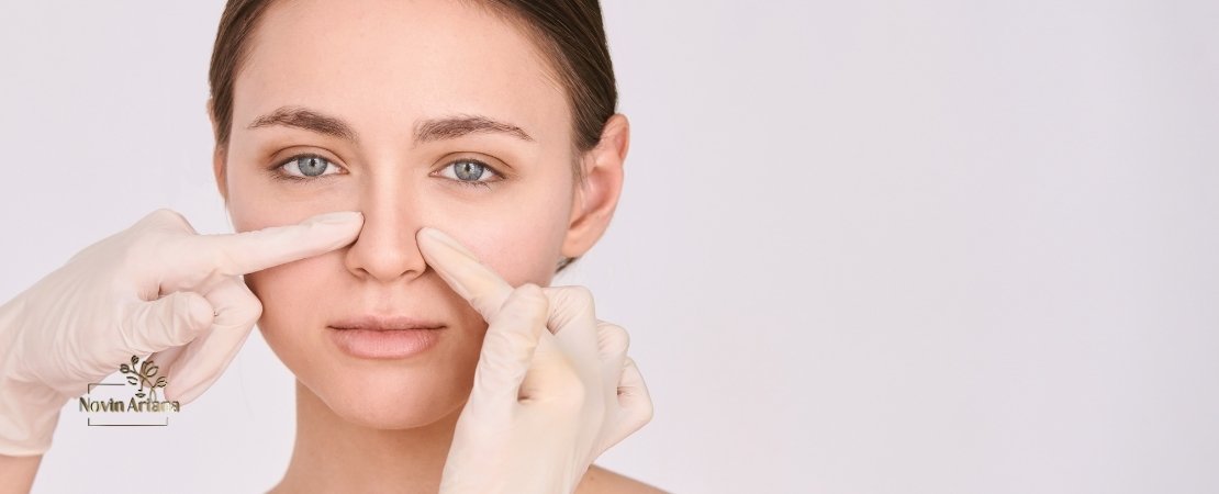 Cartilage Movement After Rhinoplasty: Causes, Risks, and Prevention