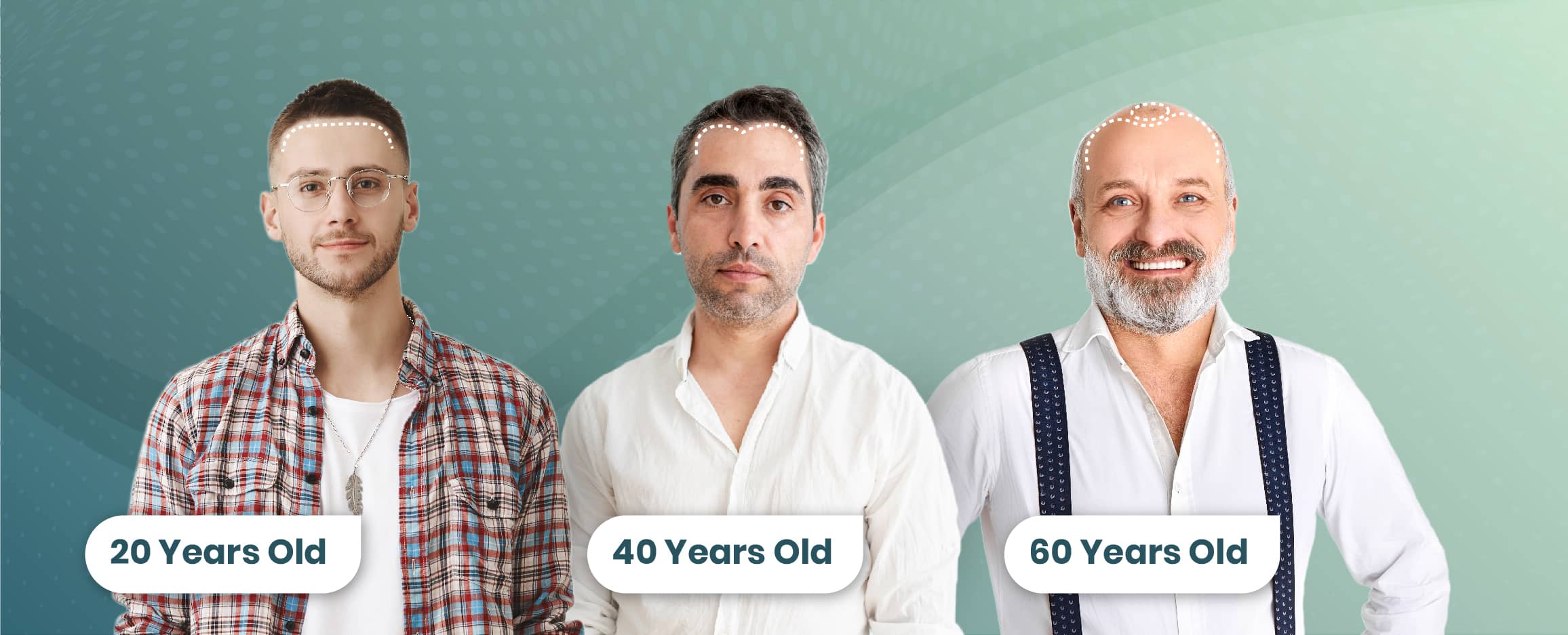 What is the best age for a hair transplant?