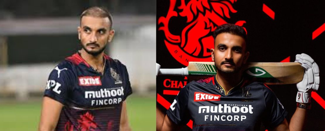 Harshal Patel Hair Transplant: The Story Behind the Transformation