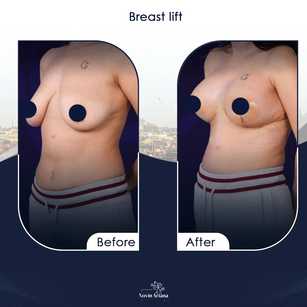 BODY3