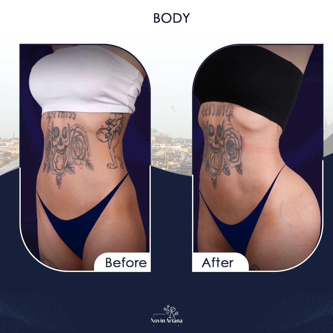 BODY5