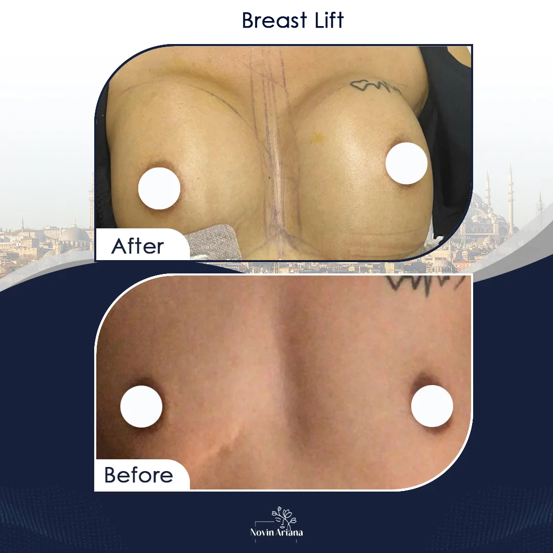 LIFT 6