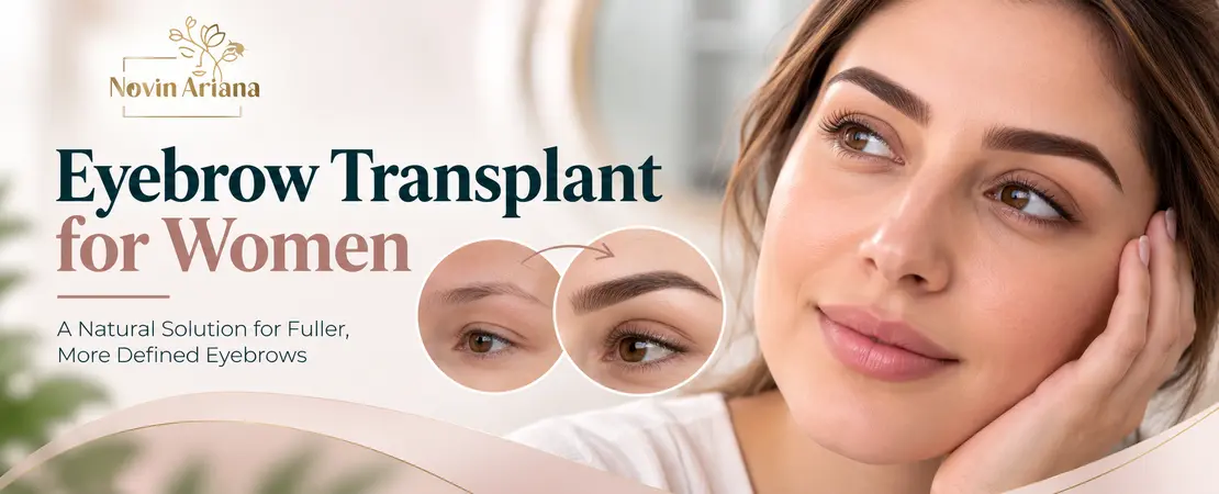 Eyebrow Transplant for Women